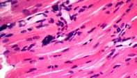 It resembles the skeletal tissue, although it contracts involuntarily. The cells in this tissue typically have only one nucleus.