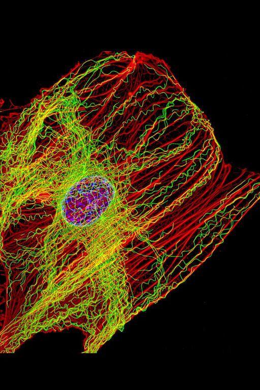 Figure 3: Fluorescence image of a cell, in which actin filaments have been tagged to fluoresce red, and microtubules have been tagged to fluoresce green.
