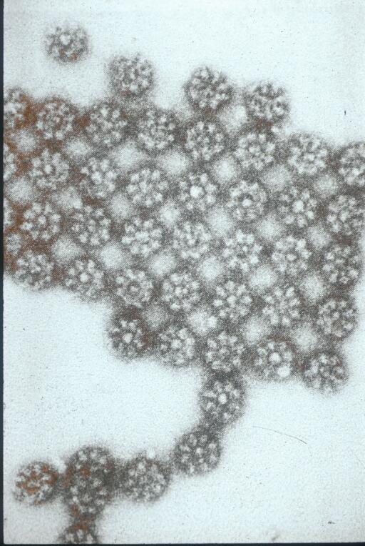 Isolated nuclear pore complexes TEM