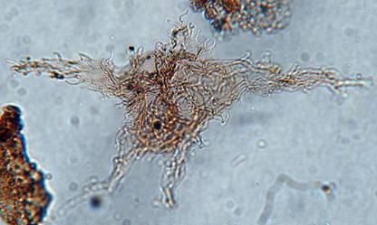 Dinocysts/Dinoflagellates Dinoflagellates are a single celled algae belonging to