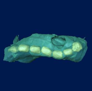 This imaging technique proves ideal for tomographic reconstruction as it generates strong