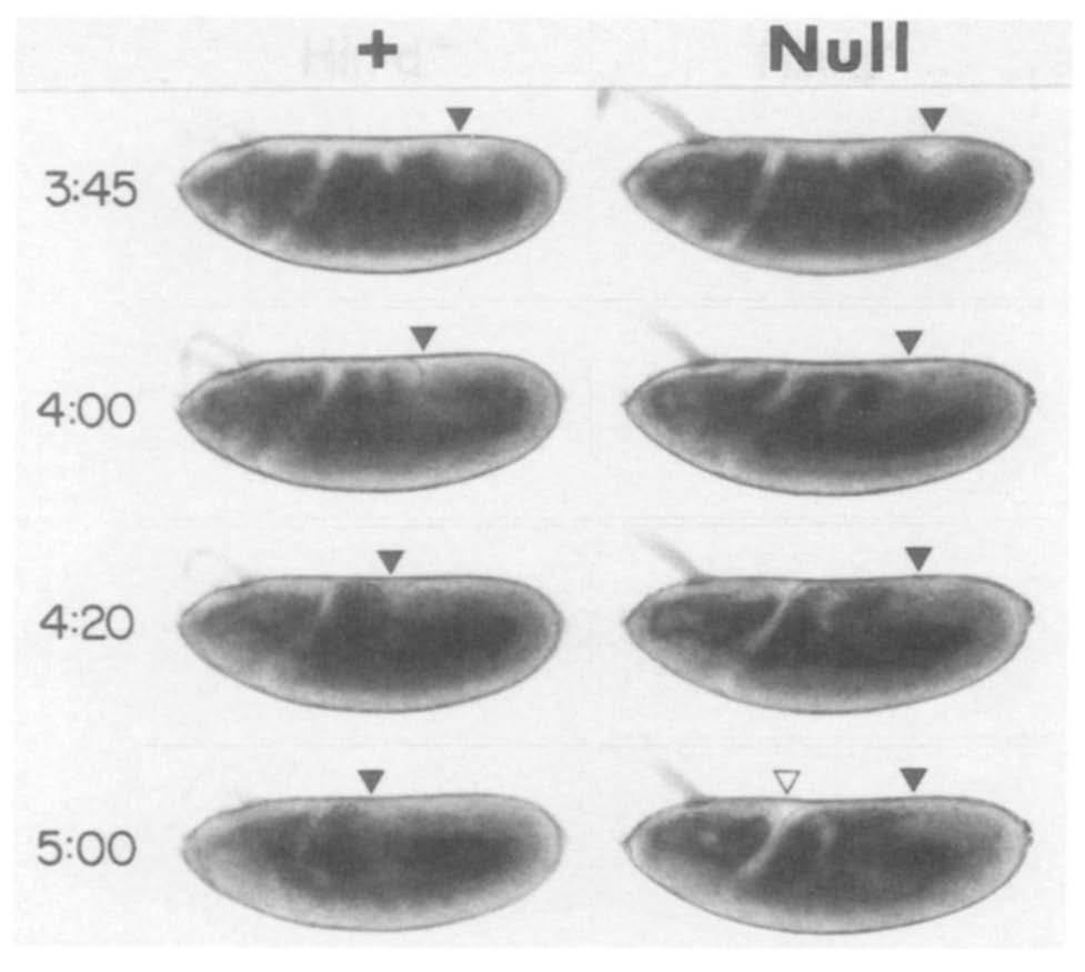Putative mutant embryos, resulting from a cross of Df(2L)DTD2, dpphm-/dp(2;2)mvd1-d2 females and dpp~maz/ Dp(2;2)DTD48 males, were followed until their genotypes could be confirmed by examining their