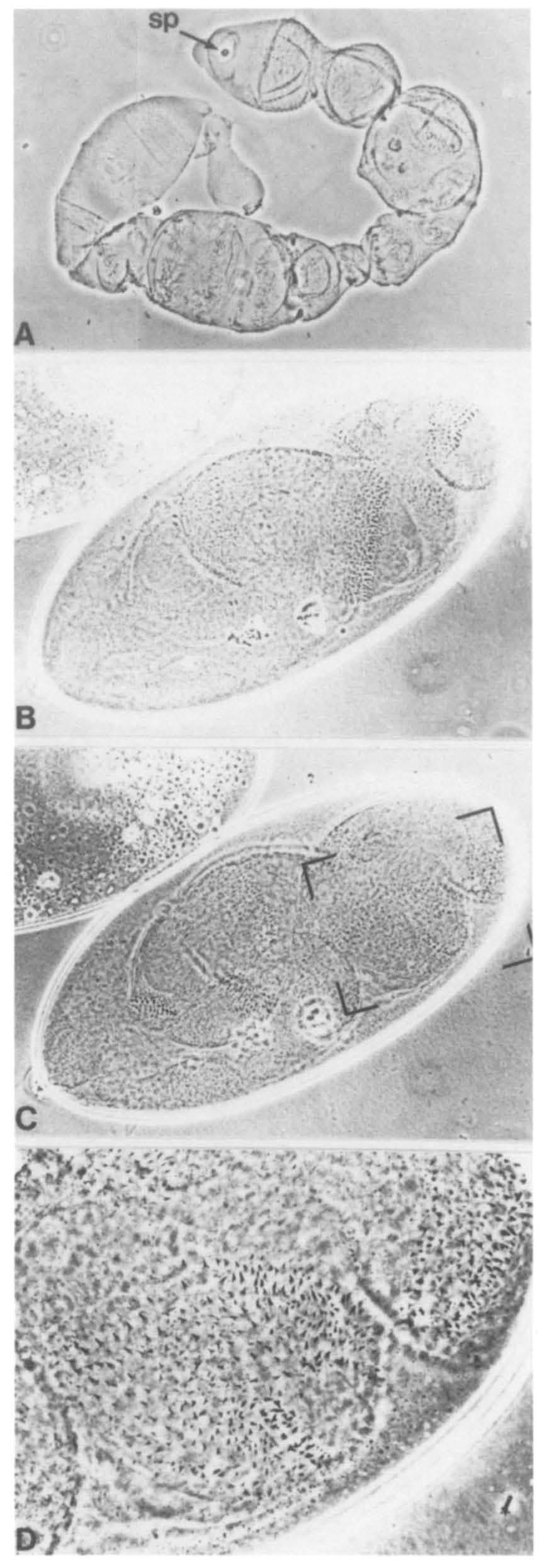 Dorso--ventral patterning Figure 6. Examples of dpp Hi~ + and dpp Hin- embryos derived from homozygous dl 1 mothers. Phase contrast views of embryos derived from dl ~ homozygous mothers.