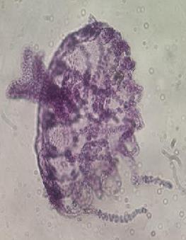 Figure 10: Obelia 4X Figure11: Obelia Medusae 40X Figure 12: Physalia Tentacle 3) Under a microscope examine prepared slide of
