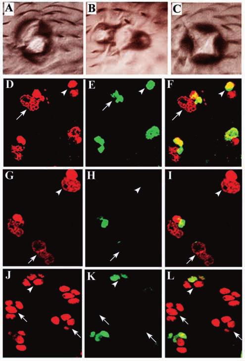 2090 G. V. Reddy and V. Rodrigues Fig. 7. Misexpression of activated Notch in the sensory lineage using GAL4 P309 and UAS-Notch intra. (A) Duplication of sockets; (B) three sockets; (C) four sockets.