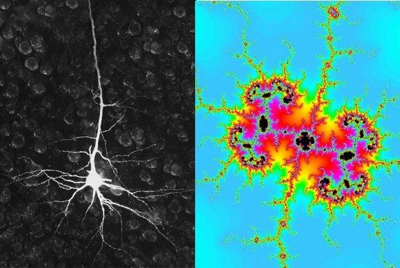 Slika 4. Neuron (levo) i mogući fraktalni model neurona (desno) Sledeću grupu predstavljaju sunđeraste ili šupljikave strukture.