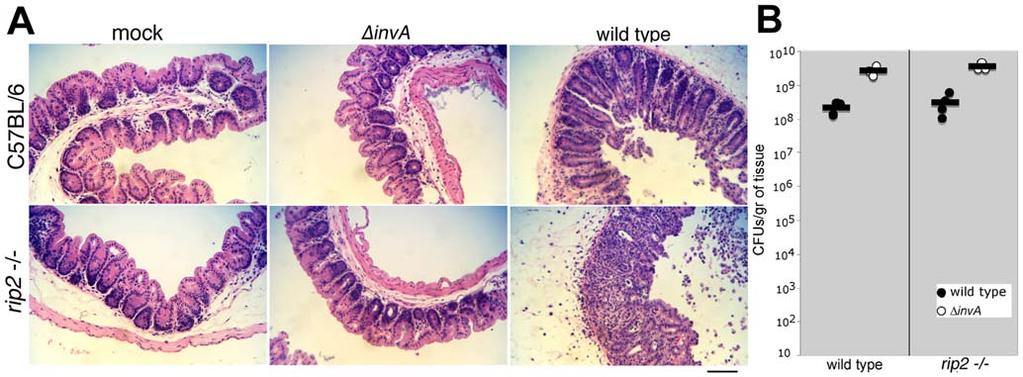 Figure 6. S. Typhimurium induces intestinal inflammation in Rip2-deficient mice.