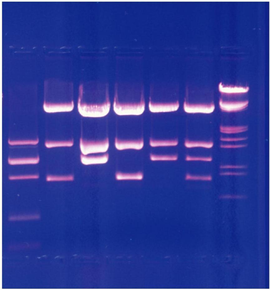 Genetics DNA fingerprinting: Number and sizes of DNA fragments (fingerprints) produced by RE digests are used to determine genetic similarities.