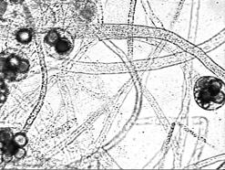 Hyphae Septa can have single or multiple pores Coenocytic hyphae -no cross walls Septate Hyphae