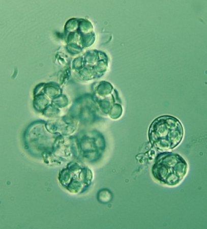 Ascus spherical, clavate or
