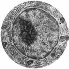 Control of rrna production Nucleolus is a specialized area of the nucleus for making rrna. Appears as dark spot.
