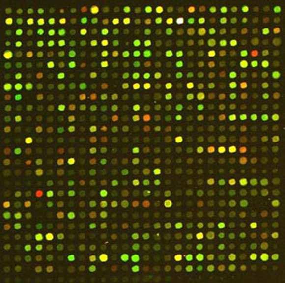 Sick vs healthy Microarray gene expressions More expressed in the