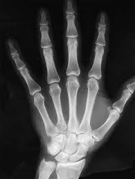 Radiographic Testing Radiography is used in a very wide range of aplications including medicine, engineering, forensics, security, etc.