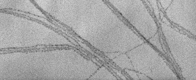 Figure S2 shows dark field STEM (scanning transmission electron microscopy) images of zinc hydroxide nanostrands.