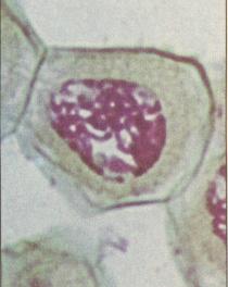 Early Prophase I Synapsed Homologous Pairs Metaphase I
