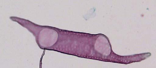 D2. Cells of secondary xylem Secondary xylem consists of the same type of cells as in primary xylem.