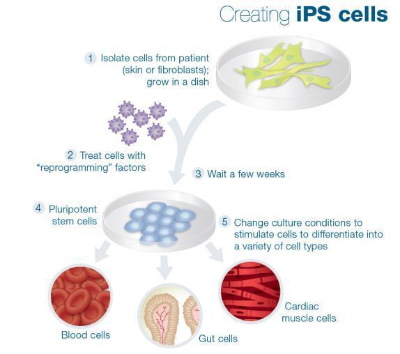 Generating stem cells that are genetically identical to a patient through ips cells ips cells are much less expensive to create than ES cells generated