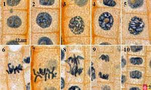 78. Name these actual stages of cell division.