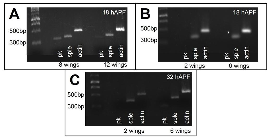 Figure 6.4 Amplification of pk, sple, and actin cdna fragments. PCR products were run on a 1.2% gen containing ethidium bromide at 120V for 1 hour alongside a 1kb DNA ladder.