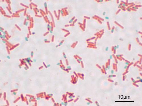 penetration of anything inside the bacteria including dyes, so they appear as clear areas within bacterial cells, while vegetative cells can be stained.