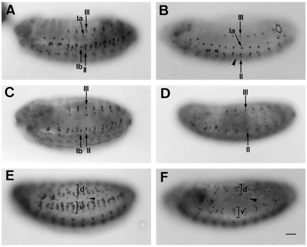 1984 E. Rushton and others Fig. 4. S59 and vg expression in wild-type and mbc C1 mutant embryos. (A) S59 expression in a 10-hour old wild-type embryo.