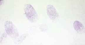 When used for fingerprint development, the reaction works best on porous surfaces such as paper, and because amino acids are relatively stable, ninhydrin development works considerably well on old