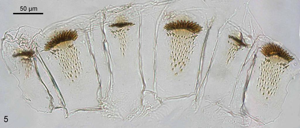 Worker. Head capsule close to a trapezoid in dorsal view, postclypeus very inflated and acuminated, Y-suture and fontanelle not visible. Antennae with 14 articles.