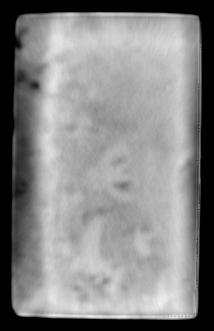 Figure 5: Longitudinal CT scan of