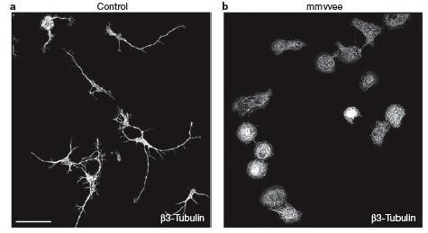 Mechanisms of neuronal migration & Filopodial protrusion and tension can induce neurite formation