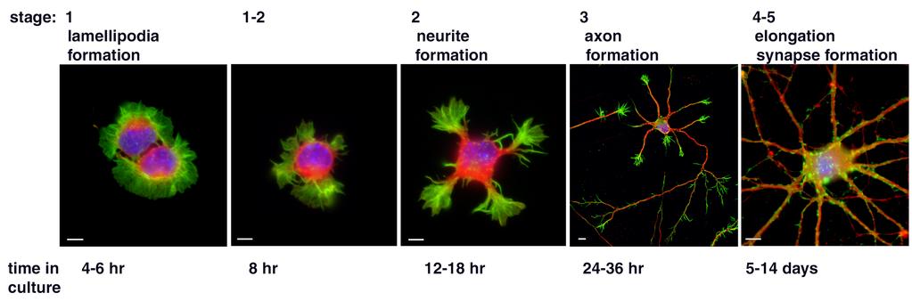 Mechanisms of neuronal migration & Neuronal polarization initiation f-actin polarization and maturation tubulin For 40 years cultures of hippocampal neurons have been used to study neuronal