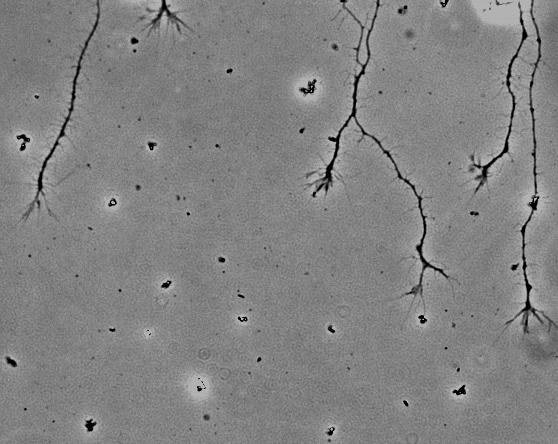 An immature neuron in cell culture first sprouts thin processes, called neurites (stage 2). After a day or so, one neurite accelerates its growth and becomes the axon.