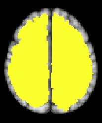 Whole brain signal Whole brain signal is related to end-.