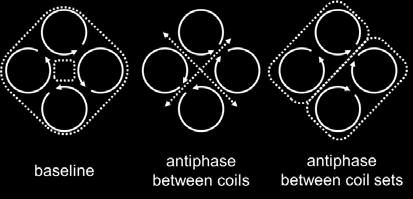 The baseline case assumed the identical phase on each coil. The antiphase case consisted of π phase difference between the individual coils.