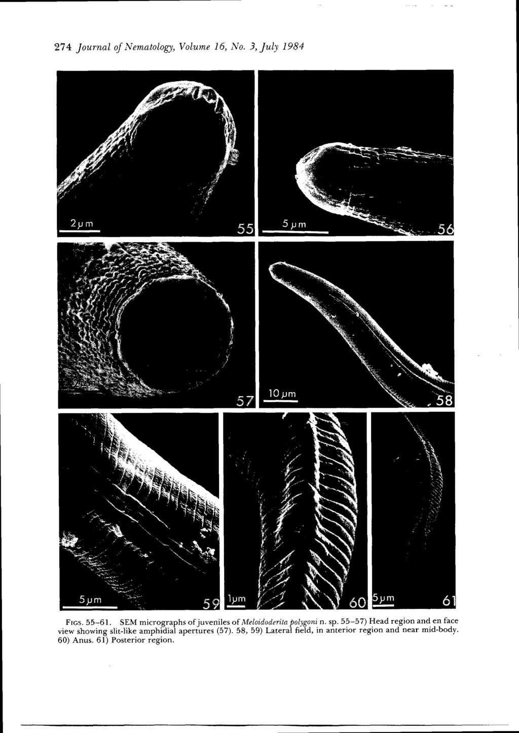 274 Journal of Nematology, Volume 16, No. 3, July 1984 \ \,,~.) ' \.~?.. -, / 5v m 6" FIGS.