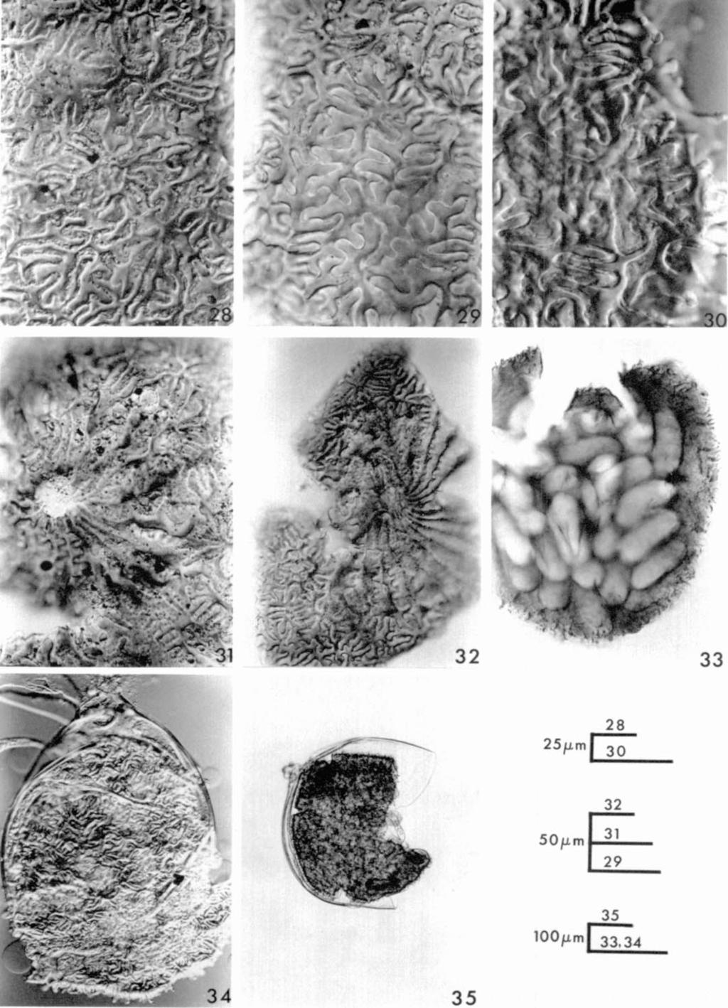 Photomicrographs of cystoid bodies of Meloidoderita polygoni n. sp.
