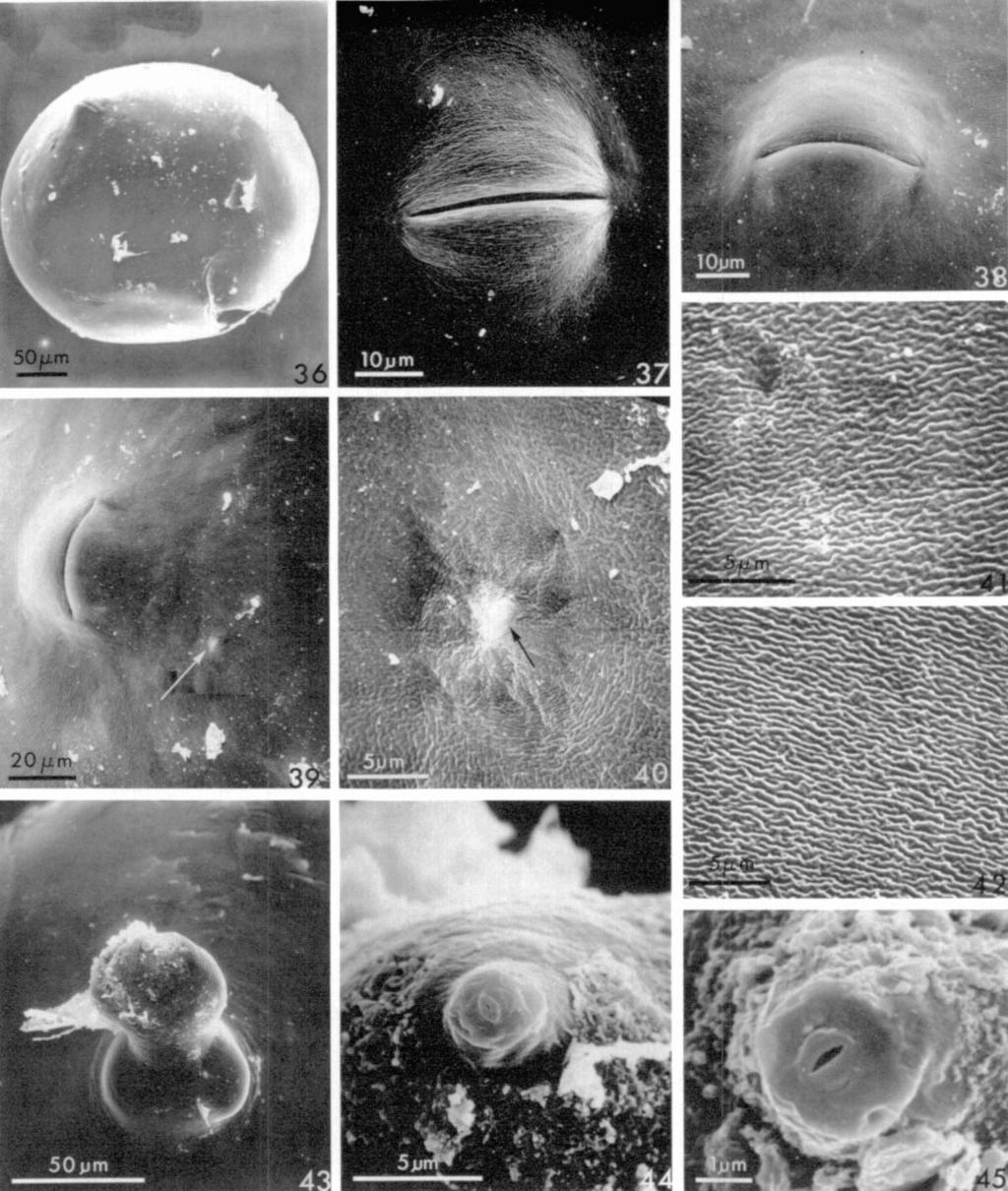 Meloidoderita Taxonomy: Golden, Handoo 271 F16s. 36-45. SEM micrographs of females ofmeloidoderita polygoni n. sp. 36) Posterior view of intact female showing protruding vulva.