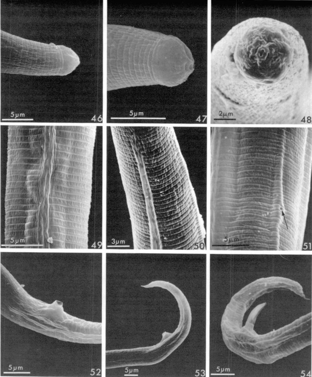 272 Journal of Nematology, Volume 16, No. 3, July 1984 ~o. \ ~" 's ~,.~,_~S,~,' j- 5,um 5~ FIGs. 46-54. SEM micrographs of males of Meloidoderita polygoni n. sp.