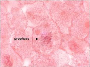 Prophase - Chromatin condenses into chromosome (chromosome packing) - Nucleolus