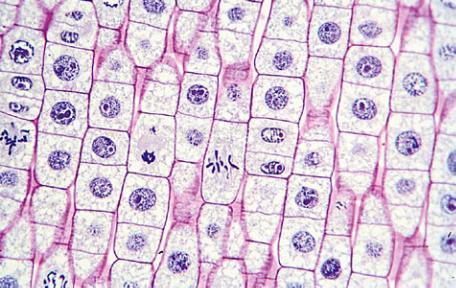 Which stages of these cells?