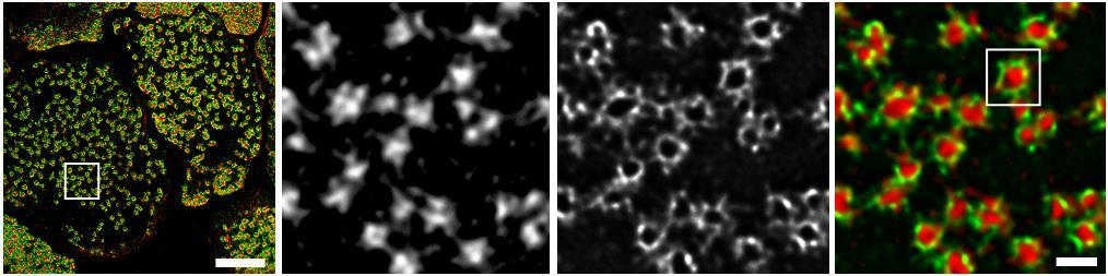Measurements of podosome size 10µm 1µm Deconvoluted images of unroofed