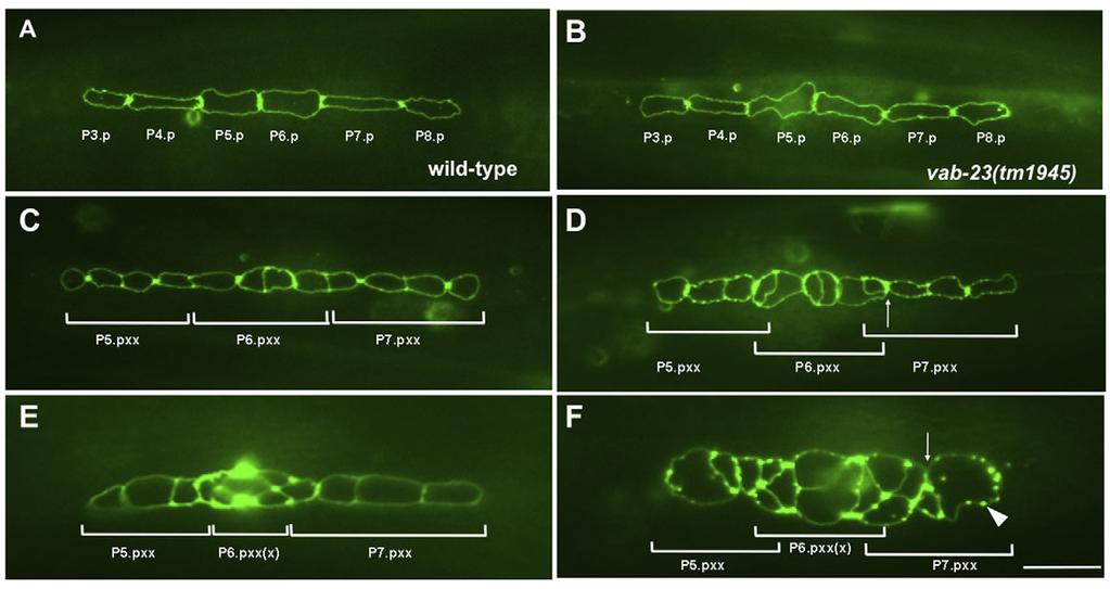 lin-39 controls morphogenesis RESEARCH ARTICLE 4653 Fig. 3. VAB-23 regulates the formation of proper vulval cell contacts.