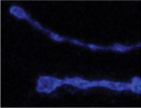 A single 6 confocal slice from a