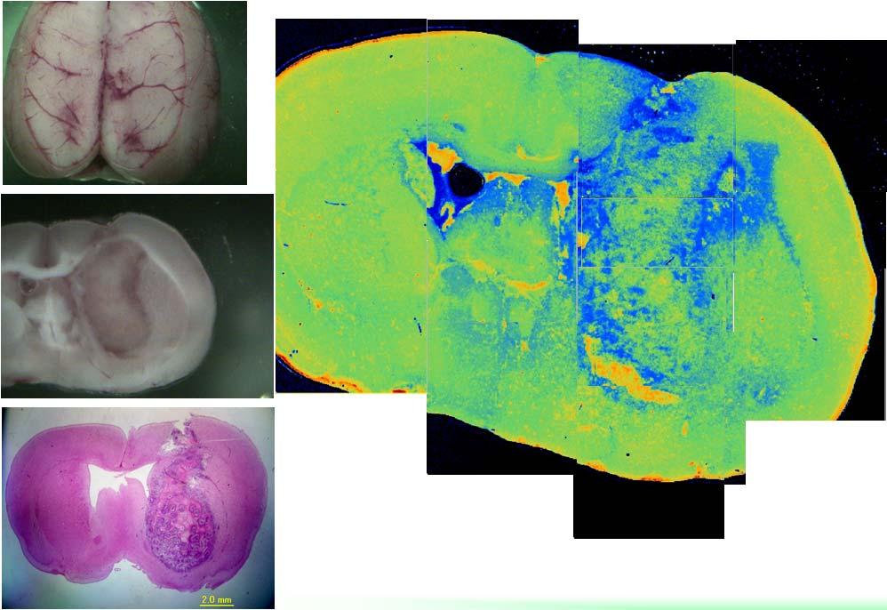 51 Observation of brain tumor mode of rat Brain tumor, rat.