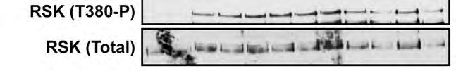 hyperphosphorylated NDRG1 species, whereas the three threonine signal intensity was not changed (Fig. 21). Thus, the GSK3 phospho-sites are not masking the phosphothr346/356/366 antibody epitope.