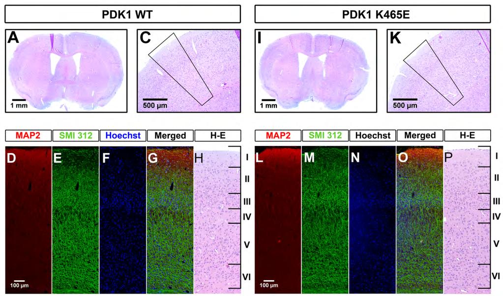 Results mentioned above, the PDK1 K465E/K465E mice are nearly viable and exhibited neither an overt phenotype nor growth abnormalities in the architecture of the central nervous system, which