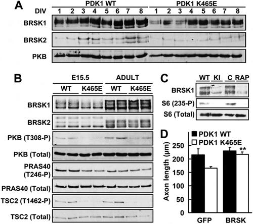 Role of PDK1/PKB Signaling in Neuronal Differentiation FIG 9 PDK1 promotes hippocampal axonogenesis through the PKB/ mtorc1/brsk pathway.