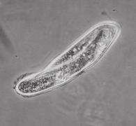 Activity.1 Animal-like Protists Phylum Mastigophora: Members of this phylum use a flagellum for locomotion. Examine Trypanosoma gambiense, a blood parasite which causes African Sleeping Sickness.