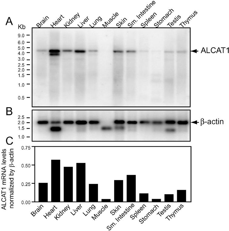 ALCAT1 Is Predominantly Expressed in