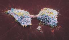 Figure 22 Cancer cells, such as the ones shown here, can be killed with carefully-measured doses of radiation.