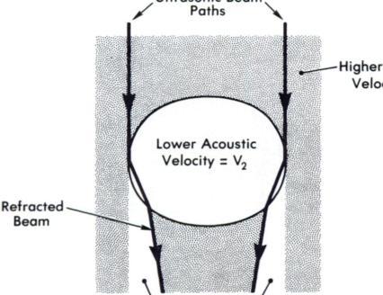 were comparable to those in the gel. No distal to the margins of the fluid collections by the acoustic shadows were seen distal to the margins of mechanism previously discussed (fig. 2).